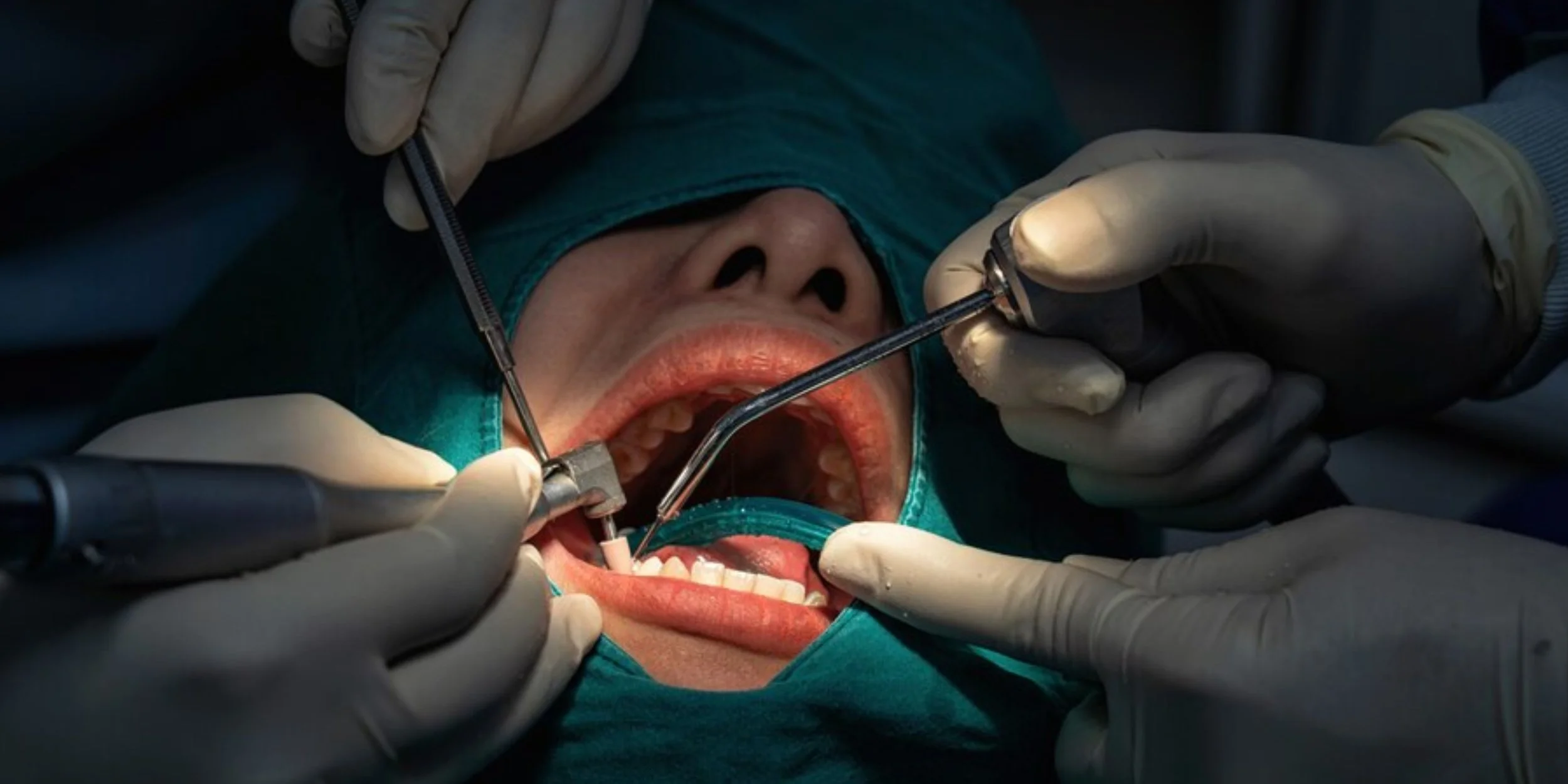 Art Chirurgie Dentaire